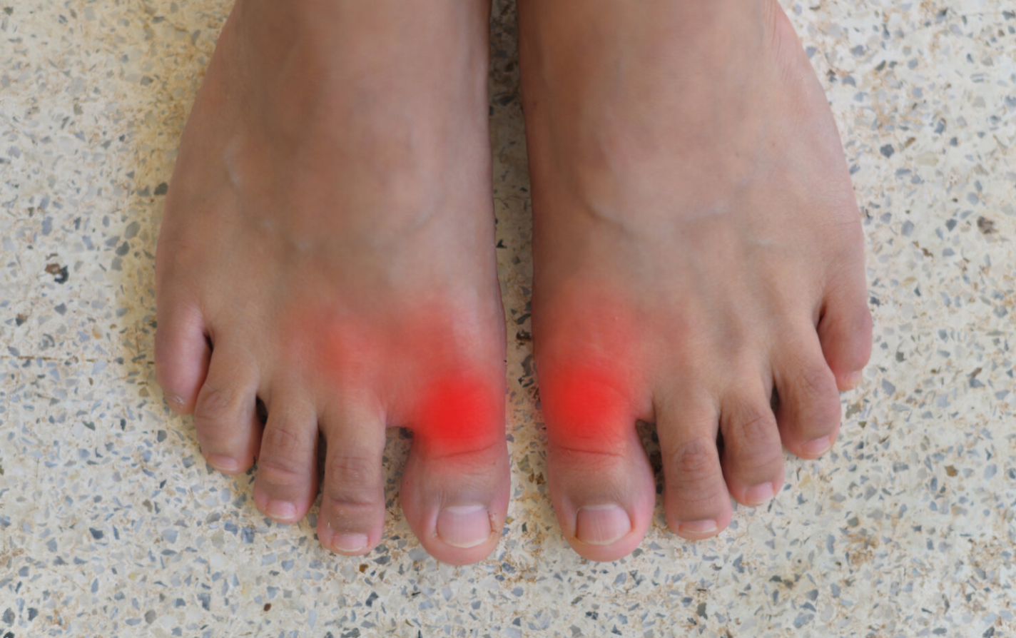 Common Causes of Big Toe Joint Pain - The Foot Clinic
